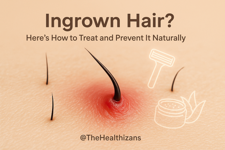 Learn what causes ingrown hair and how to treat and prevent it naturally for smoother, clearer skin.