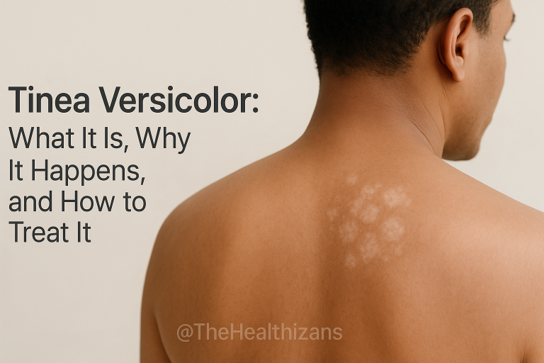 Tinea Versicolor: What It Is, Why It Happens, and How to Treat It